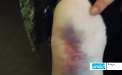 فرار پشت فرار؛ هیچ خانه‌ای برای «ربابه» امن نیست