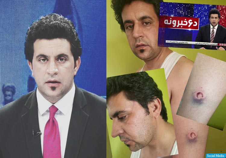 افراد طالبان یک گویندهی آریانانیوز را بازداشت و به شدت شکنجه کردند