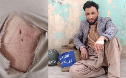 طالبان خبرنگار «راه فردا» را به اتهام همکاری با طراحان انفجارهای امروز بازداشت و لت‌وکوب کردند