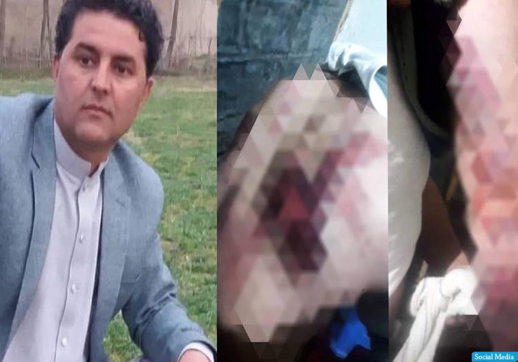 طالبان یک داکتر نظامی در بدخشان را برای گرفتن اعتراف اجباری شدیدا شکنجه کردند